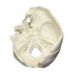Replica Human Male with Machete Wounds Skull