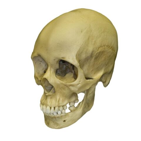 Replica Human Female with Multiple Gunshot Wounds Skull
