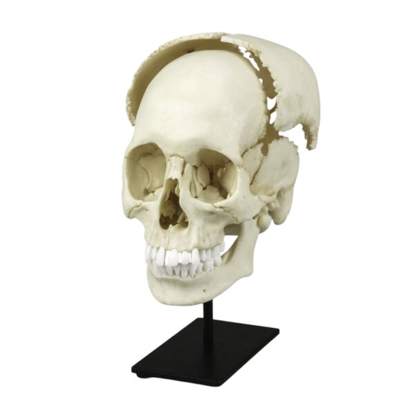 Replica Human Medical Study Skull – Articulated