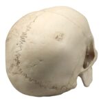Replica Human Skull – Porotic Hyperostosis and Cribra Orbitalia