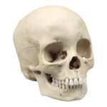Replica Human Skull – Porotic Hyperostosis and Cribra Orbitalia