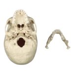 Replica Human Skull – Porotic Hyperostosis and Cribra Orbitalia
