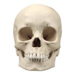 Replica Human Skull – Porotic Hyperostosis and Cribra Orbitalia
