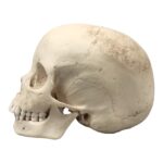 Replica Human Skull – Porotic Hyperostosis and Cribra Orbitalia