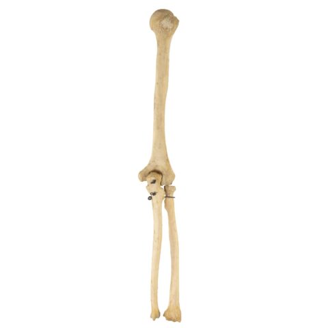 Real Human Humerus, Radius, and Ulna - 209.79 g