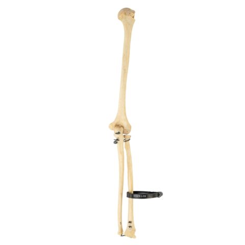 Real Human Humerus, Radius, and Ulna - 110.565 g