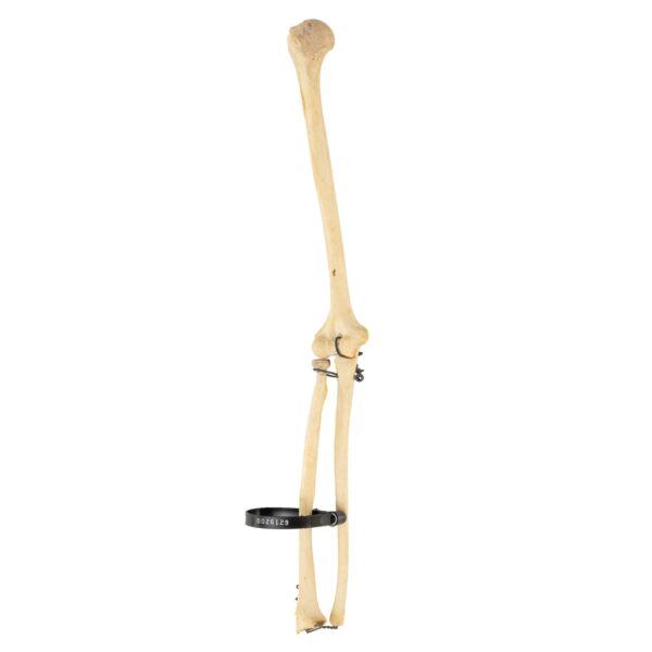 Real Human Humerus, Radius, and Ulna – 110.565 g