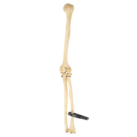 Real Human Humerus, Radius, and Ulna - 119.07 g