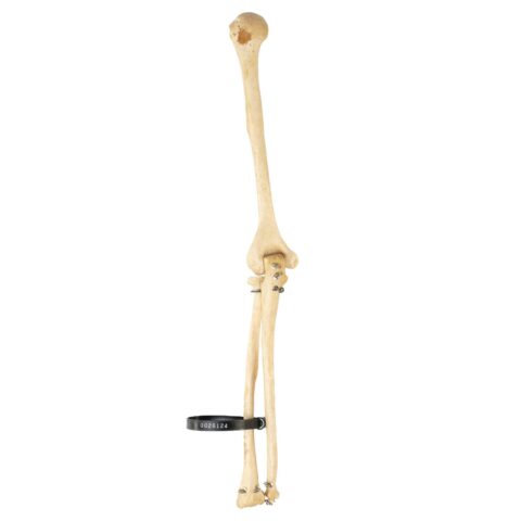 Real Human Humerus, Radius, and Ulna - 119.07 g