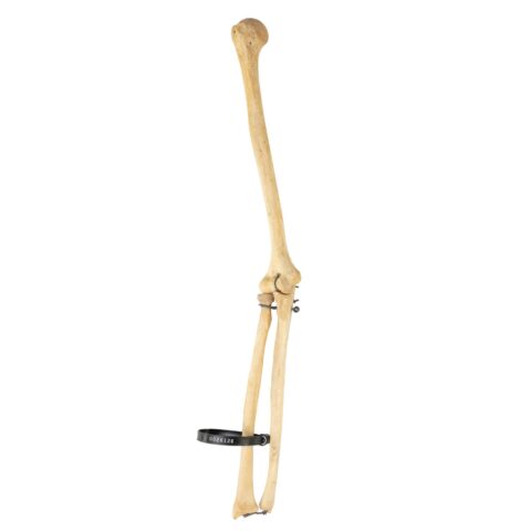Real Human Humerus, Radius, and Ulna - 141.75 g