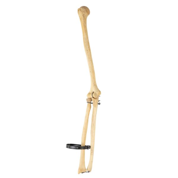 Real Human Humerus, Radius, and Ulna – 141.75 g