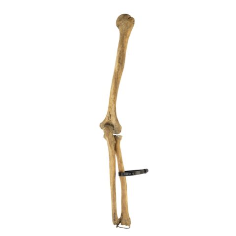 Real Human Humerus, Radius, and Ulna - 226.8 g