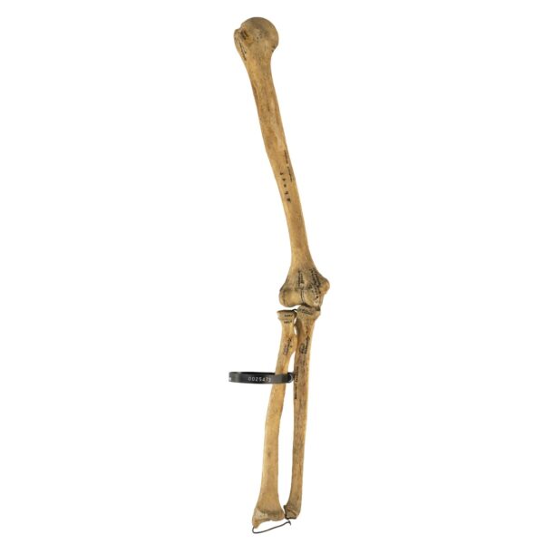 Real Human Humerus, Radius, and Ulna – 226.8 g