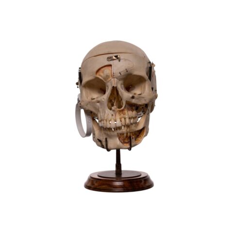 Real Human Skull - Dissected - With Stand