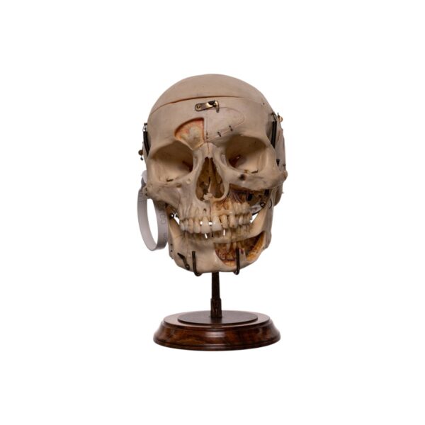 Real Human Skull – Dissected – With Stand