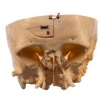 Real Human Partial Skull – Dissected – 332 g