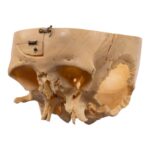 Real Human Partial Skull – Dissected – 332 g