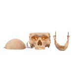 Real Human Skeleton – Disarticulated – 3600 g