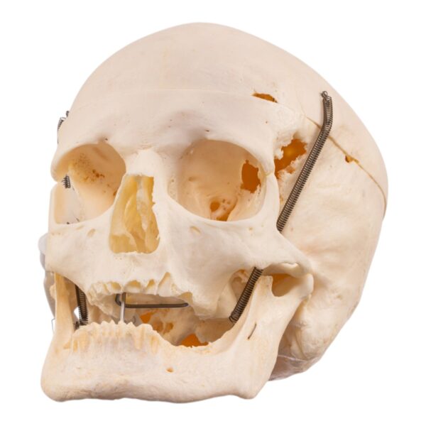 Real Human Skull