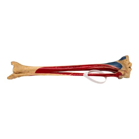 Real Human Tibia and Fibula - Painted