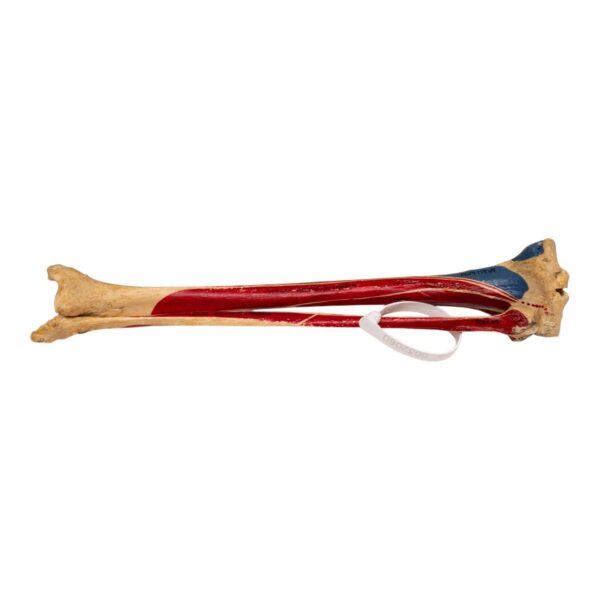 Real Human Tibia and Fibula – Painted