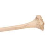 Real Human Left Tibia – Pathology