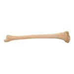 Real Human Tibia – Pathology