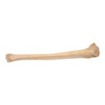 Real Human Tibia – Pathology
