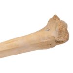 Real Human Tibia – Pathology