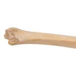 Real Human Tibia – Pathology