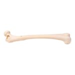 Real Human Femur – Pathology