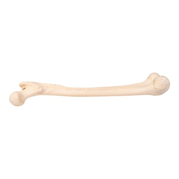 Real Human Femur – Pathology
