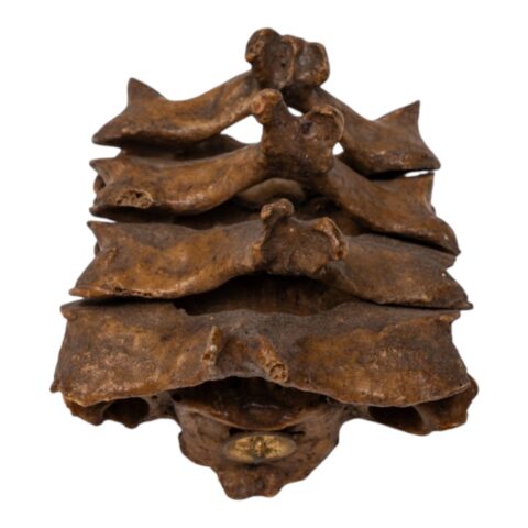 Real Human Vertebrae Set
