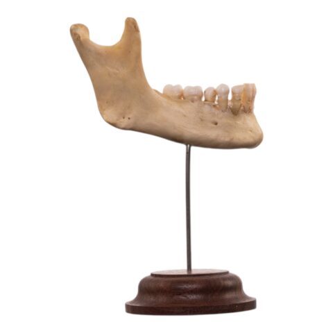 Real Human Partial Mandible