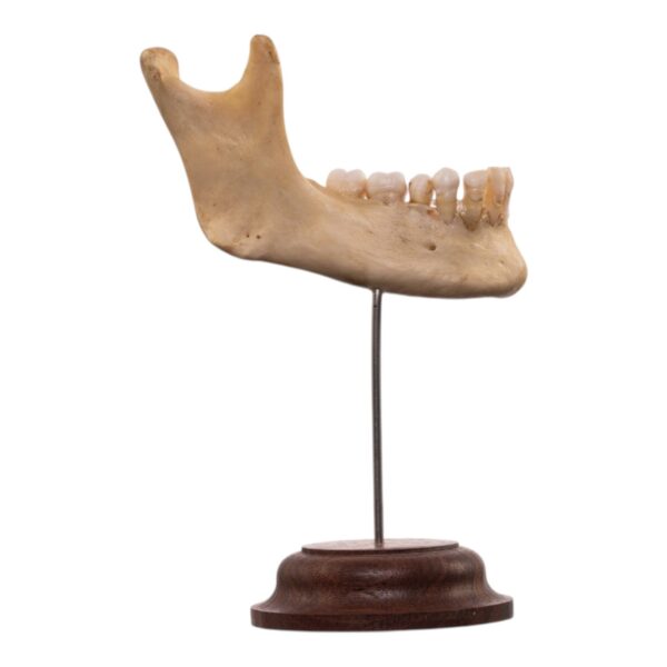 Real Human Partial Mandible