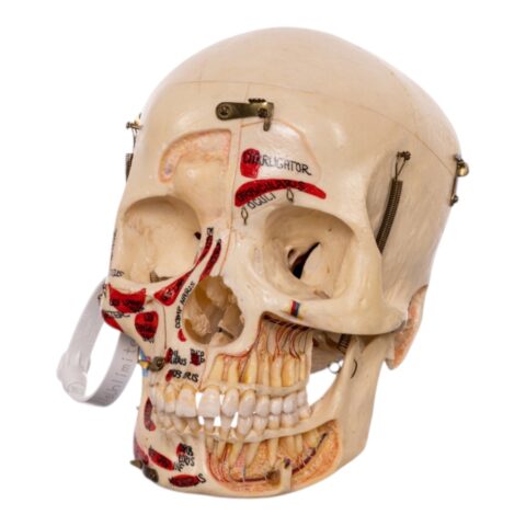 Real Human Dissected Skull in Carrying Case