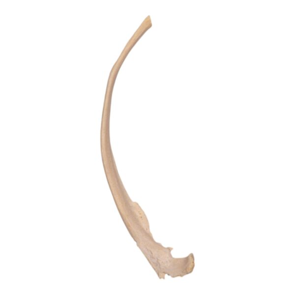 Real Human Rib – Pathology