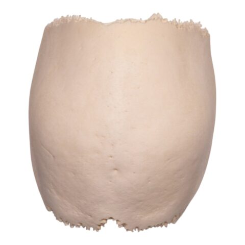 Real Human Partial Cranial Vault - 150 g
