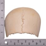 Real Human Partial Cranial Vault – 120 g