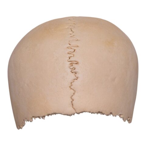 Real Human Partial Cranial Vault - 120 g
