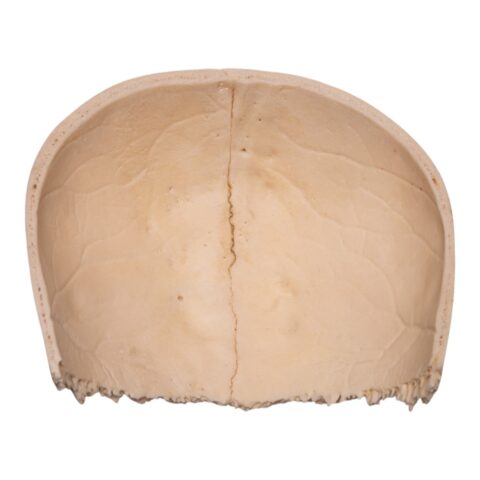 Real Human Partial Cranial Vault - 120 g