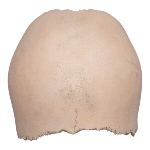 Real Human Partial Cranial Vault – 104 g