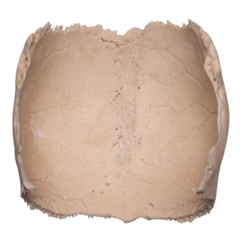 Real Human Partial Cranial Vault - 104 g