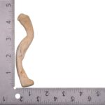 Real Human Clavicle – Pathology