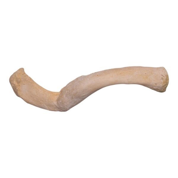 Real Human Clavicle – Pathology