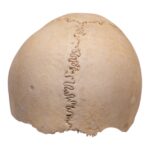 Real Human Partial Cranial Vault – 106 g