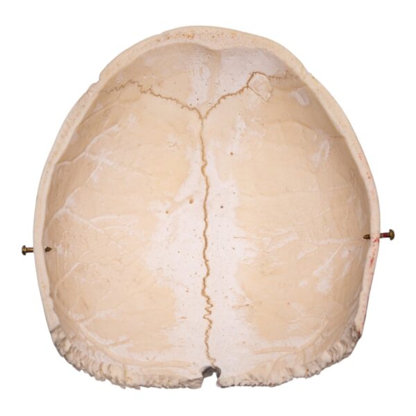 Real Human Partial Cranial Vault – 206 g