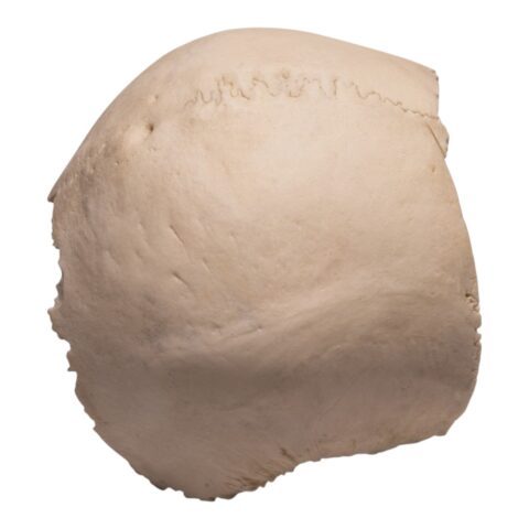 Real Human Partial Cranial Vault - 230 g