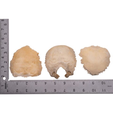 Real Human Child Occipital Bone