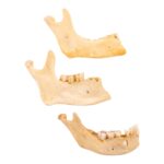 Real Human Partial Mandible – Set of 3